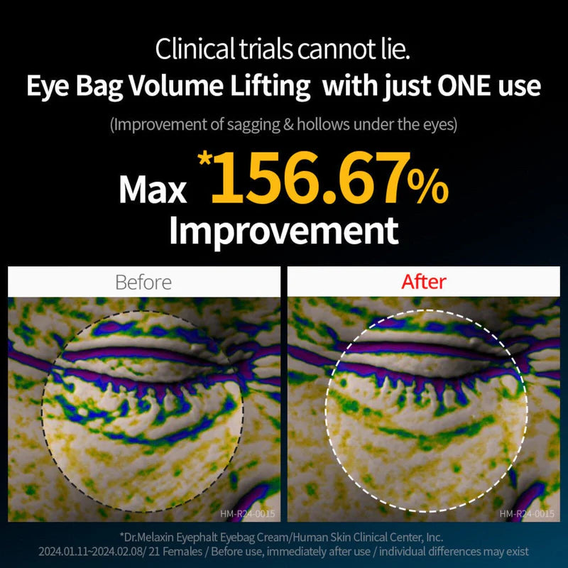Dr. Melaxin Eyephalt