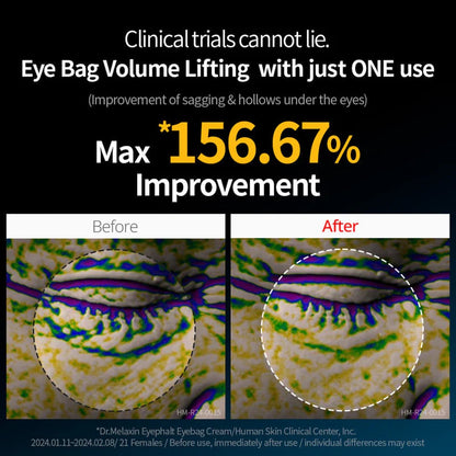 Dr. Melaxin Eyephalt